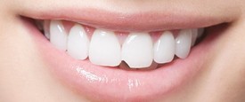 Chipped tooth dental care
